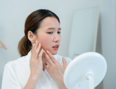 acne-and-acne-scarring-treatment-img Houston Wellness & Aesthetics|Laser and Light Treatments