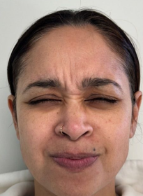 Houston Wellness & Aesthetics|Before and After Gallery