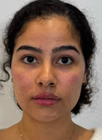 Houston Wellness & Aesthetics|Before and After Gallery