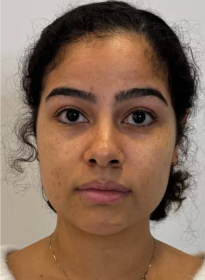 Houston Wellness & Aesthetics|Before and After Gallery