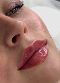 Houston Wellness & Aesthetics|Before and After Gallery