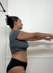 SculpSure-after Houston Wellness & Aesthetics|Before and After Gallery