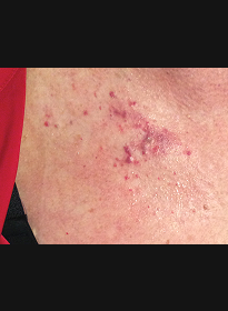 Skin-Revitalization-after-15 Houston Wellness & Aesthetics|Before and After Gallery