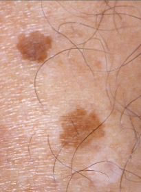 Skin-Revitalization-before-4 Houston Wellness & Aesthetics|Before and After Gallery