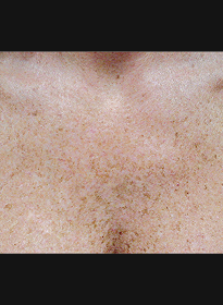 Skin-Revitalization-before Houston Wellness & Aesthetics|Before and After Gallery
