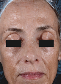 ThreeForMe-after-3 Houston Wellness & Aesthetics|Before and After Gallery