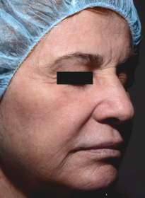 ThreeForMe-after Houston Wellness & Aesthetics|Before and After Gallery