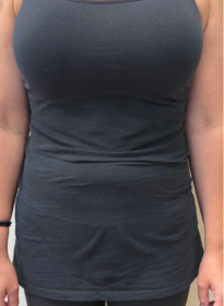 Weight-Loss-after-2 Houston Wellness & Aesthetics|Before and After Gallery