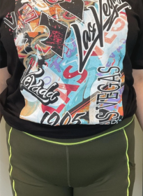 Weight-Loss-before-2 Houston Wellness & Aesthetics|Before and After Gallery