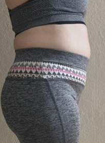 Weight-Loss-before-3 Houston Wellness & Aesthetics|Before and After Gallery