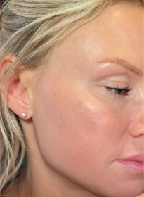 Houston Wellness & Aesthetics|Before and After Gallery