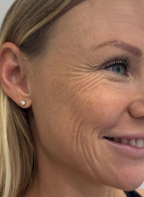 Houston Wellness & Aesthetics|Before and After Gallery